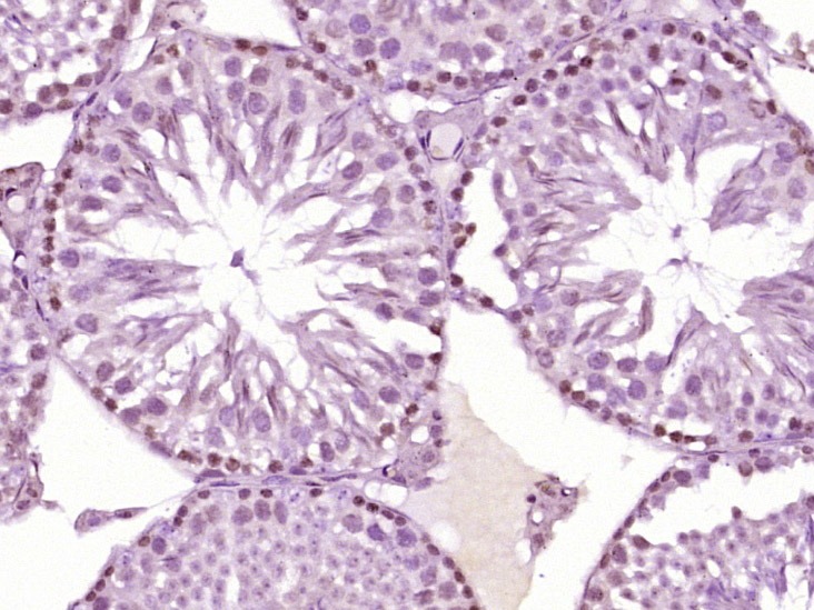 Anti-HOXA10 Polyclonal Antibody