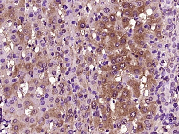 Anti-HO-1 Polyclonal Antibody