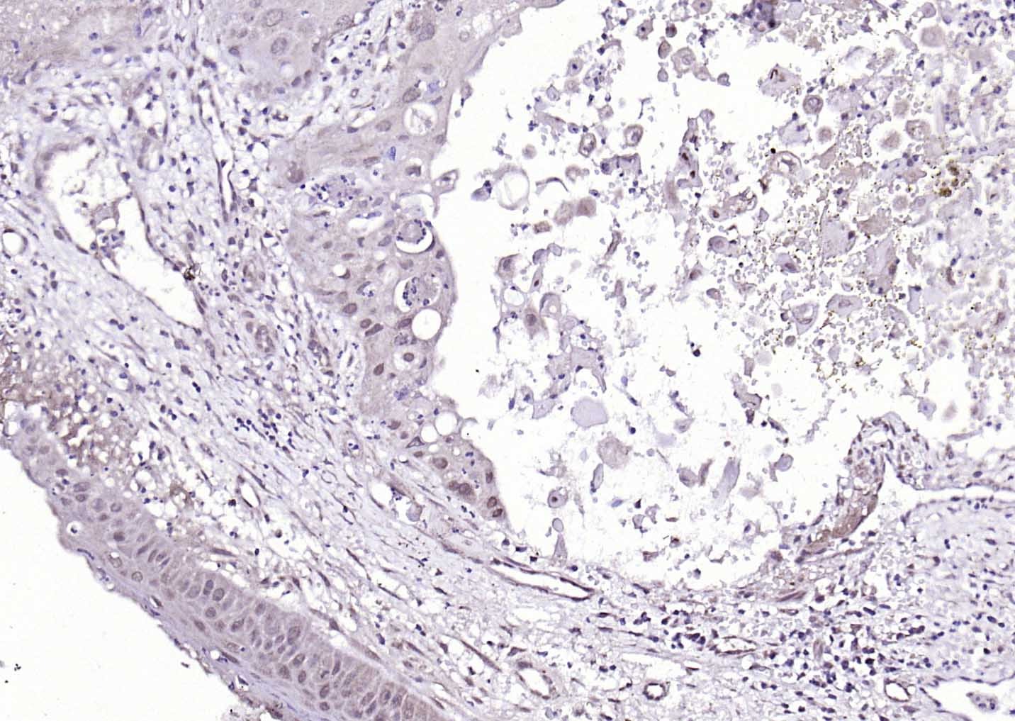 Anti-HPV16 E7 Polyclonal Antibody 3