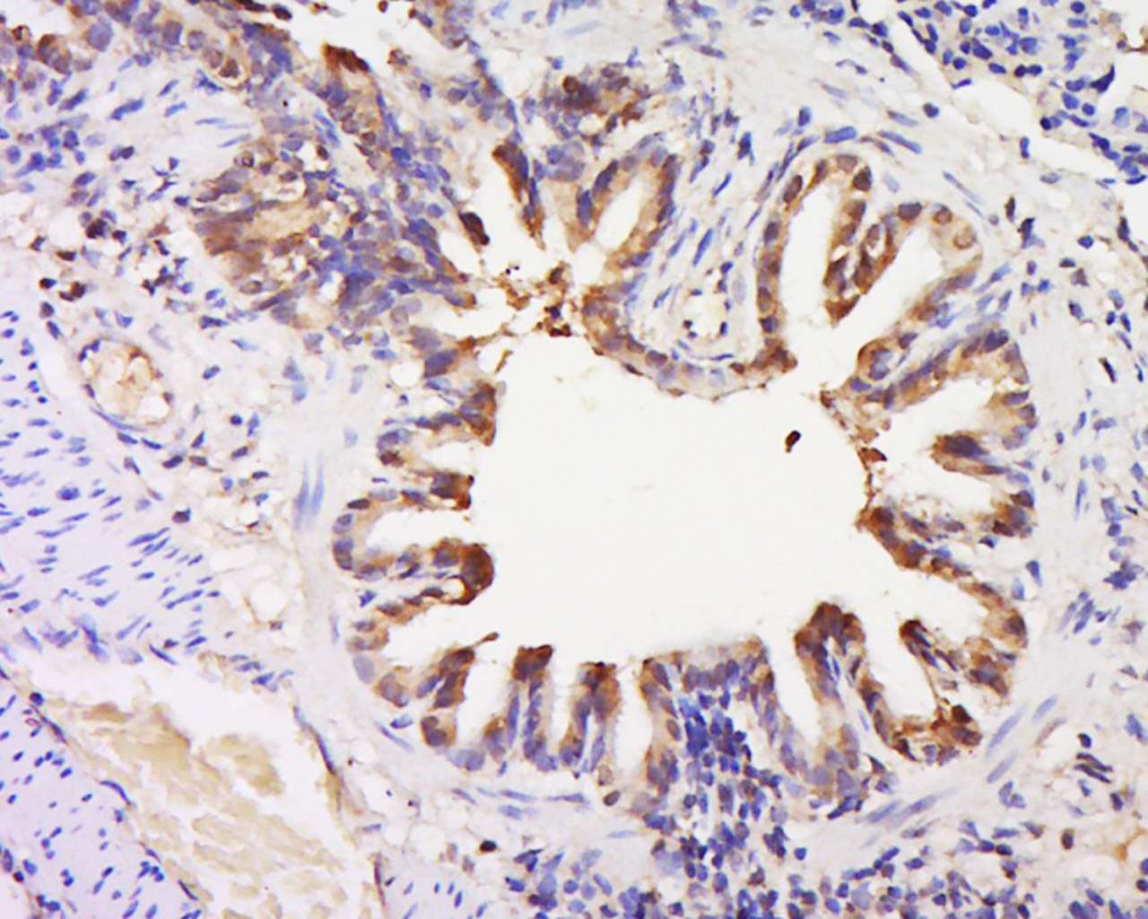 Anti-GPR92 Polyclonal Antibody