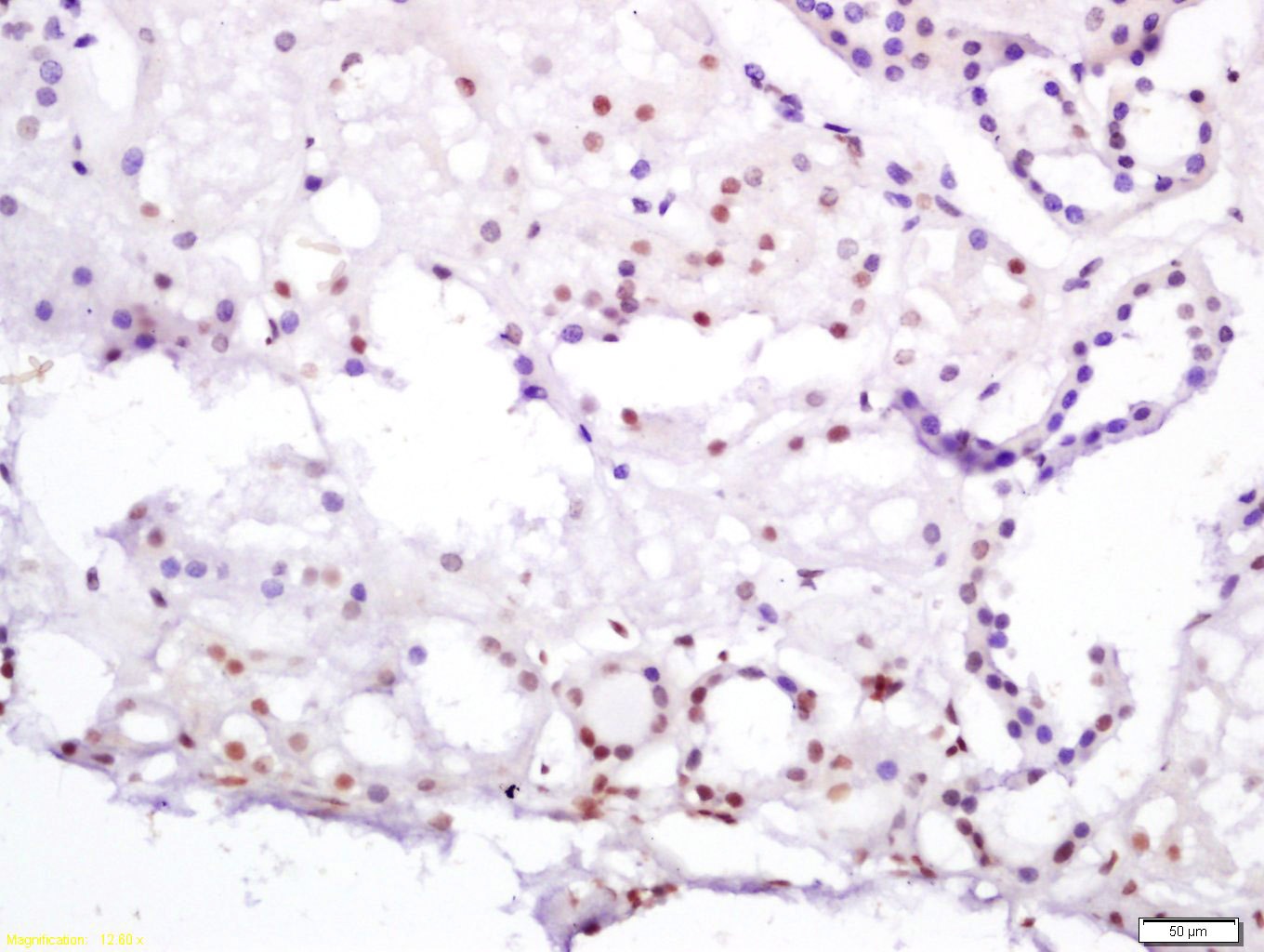 Anti-HNF4A Polyclonal Antibody