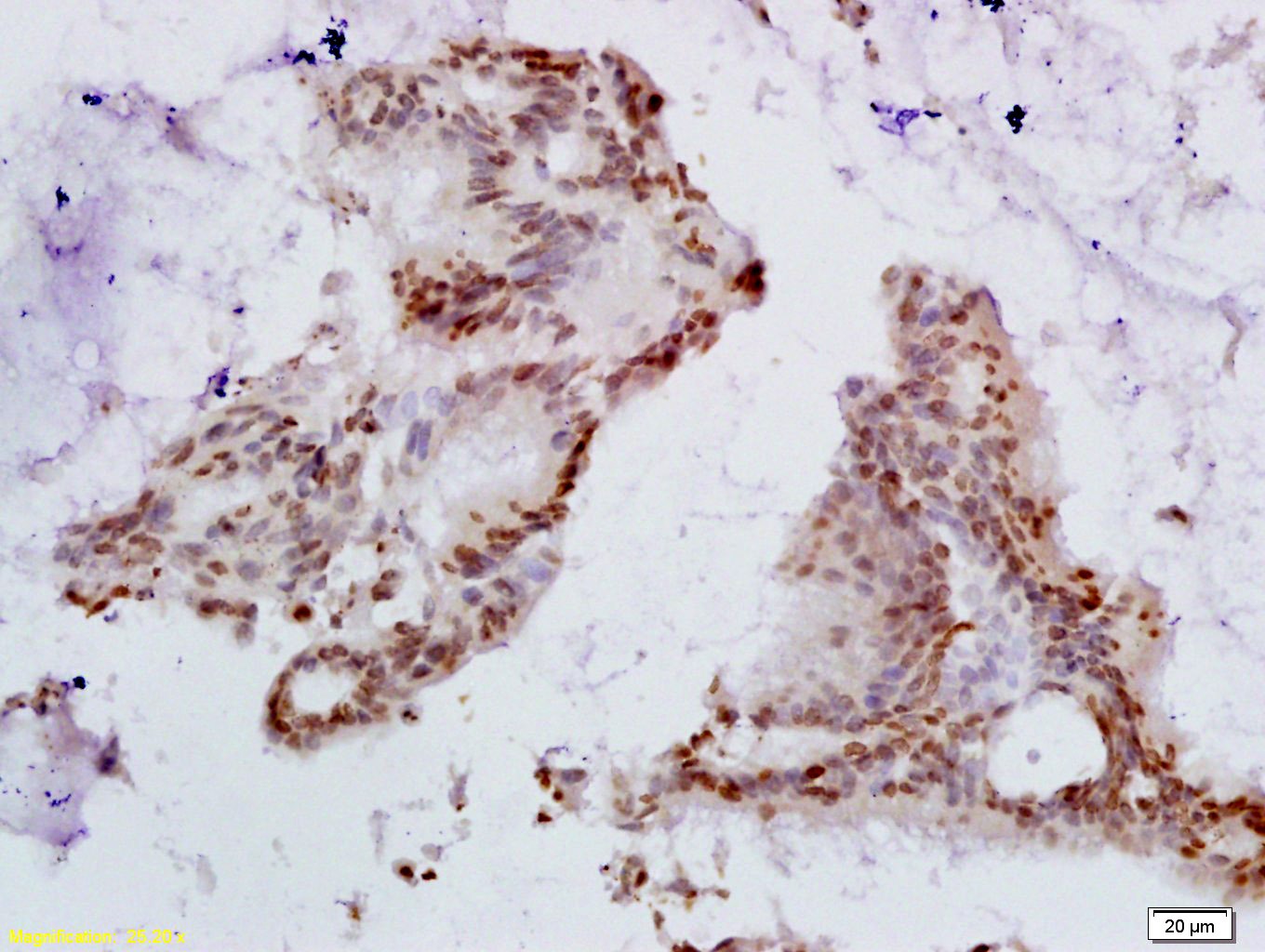 Anti-HPV16 E6 / HPV18 E6 Polyclonal Antibody
