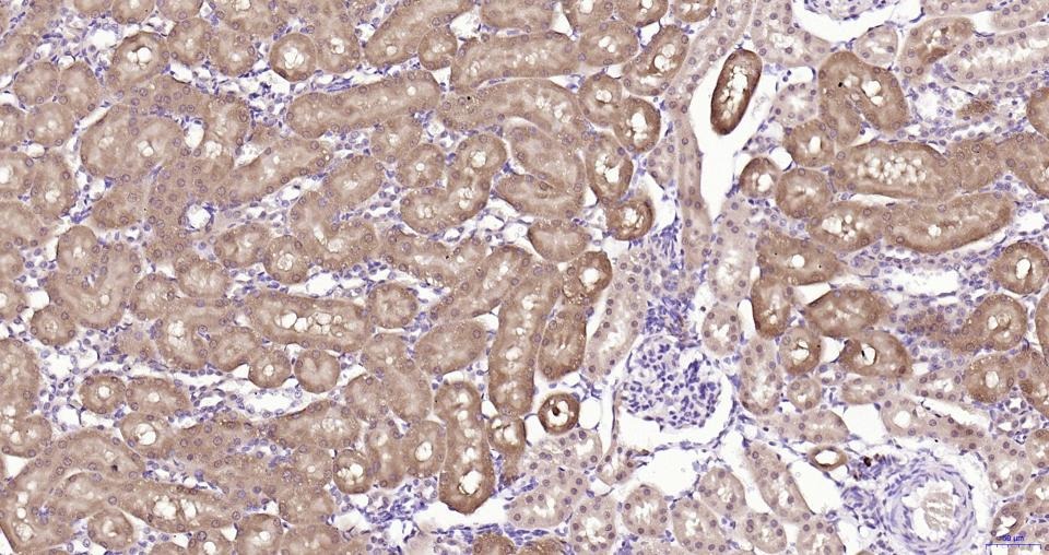 Anti-GPX4 Antibody (1B328)