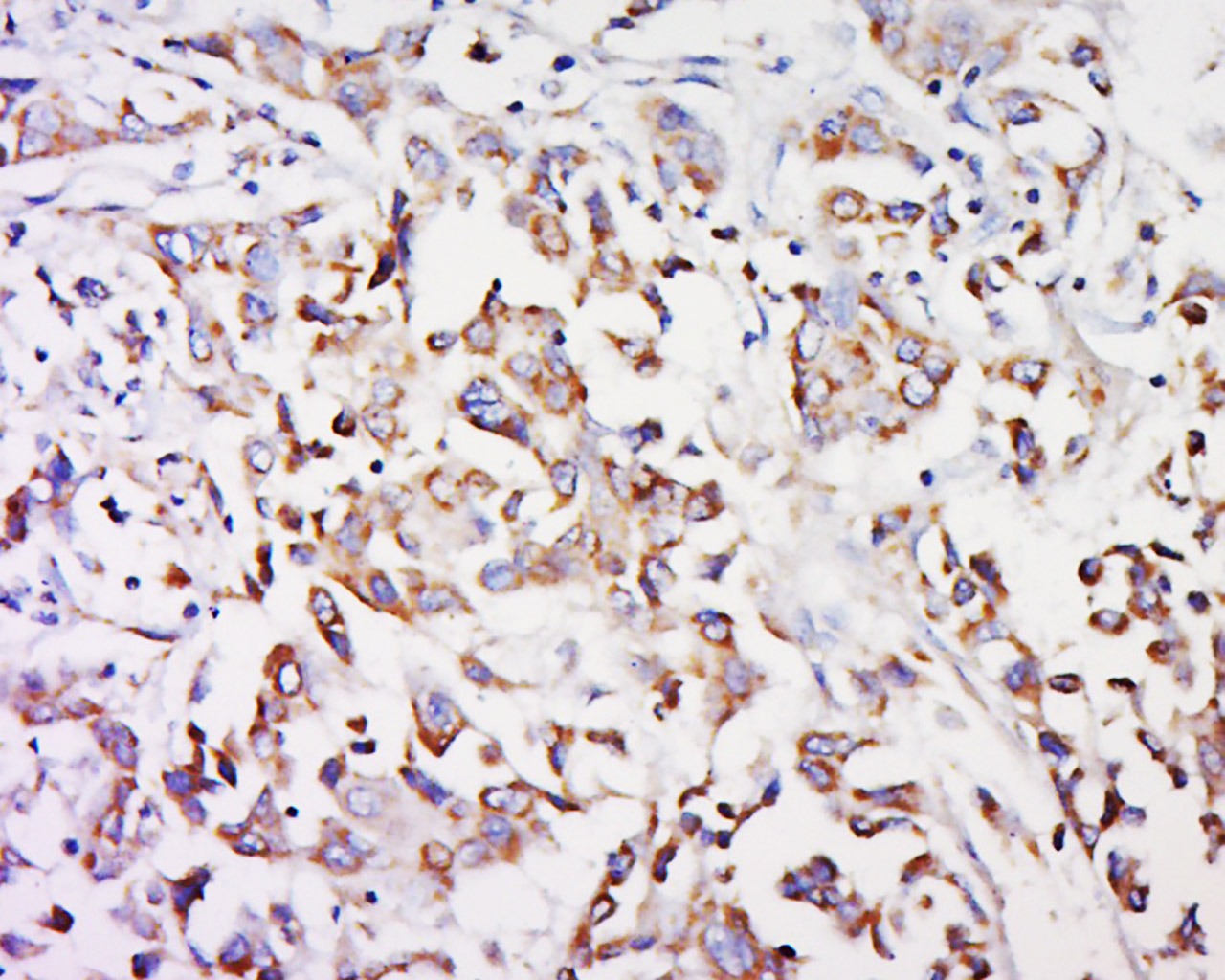 Anti-GPR91 Polyclonal Antibody