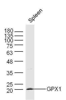 Anti-GPX1 Polyclonal Antibody