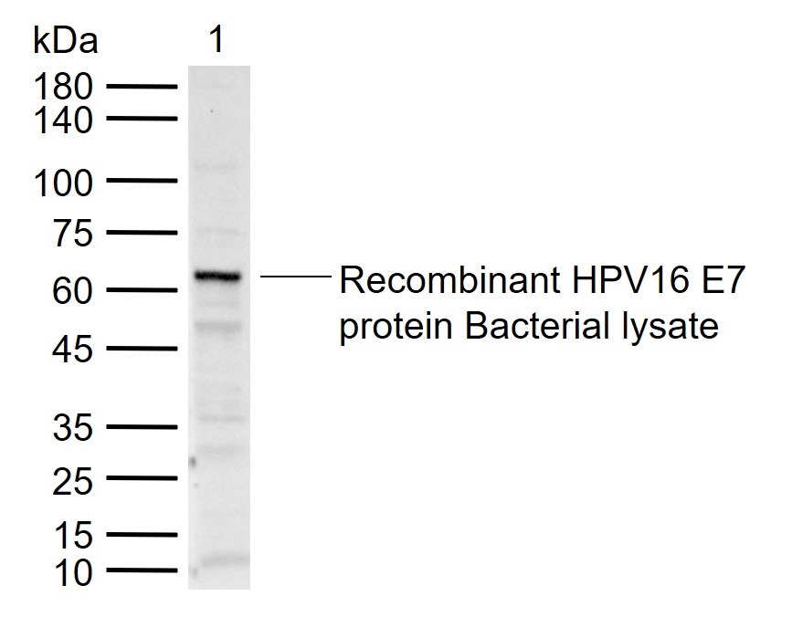 Anti-HPV16 E7 Polyclonal Antibody 3