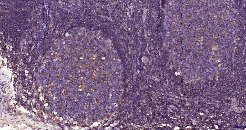 Anti-GPX4 Antibody (1B328)