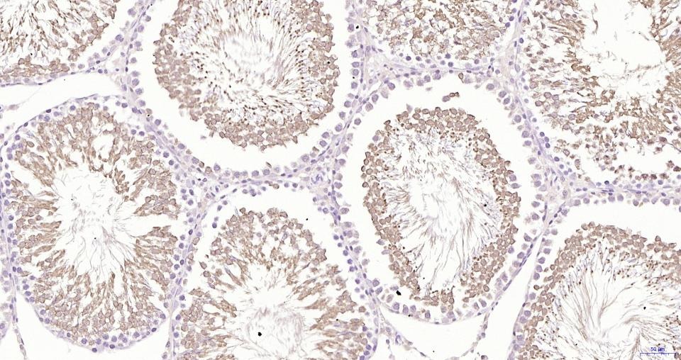Anti-GPX4 Antibody (1B328)