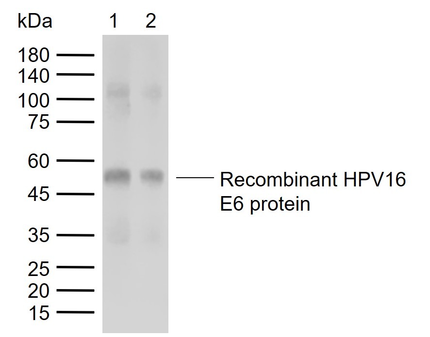 Anti-HPV16 E6 / HPV18 E6 Polyclonal Antibody