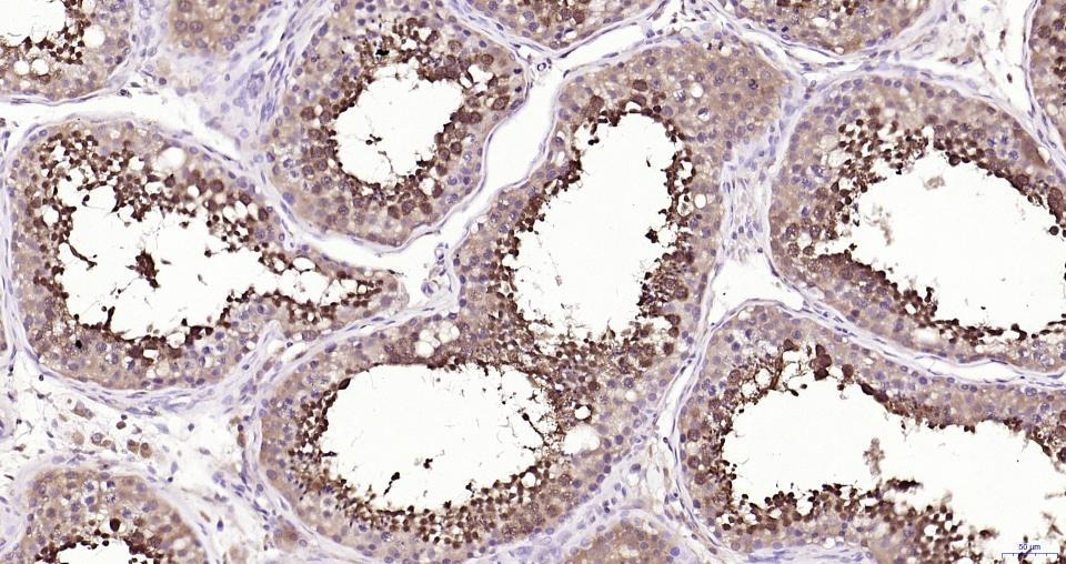Anti-GPX4 Antibody (1B328)