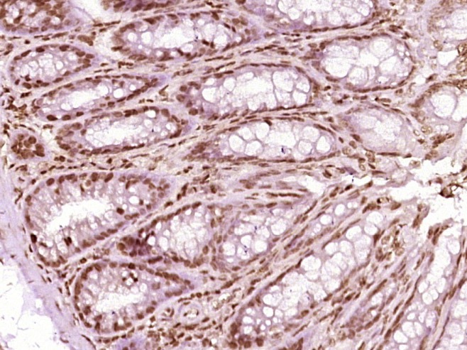 Anti-HNRNPA2B1 Polyclonal Antibody