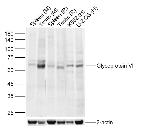 Anti-GPVI Polyclonal Antibody