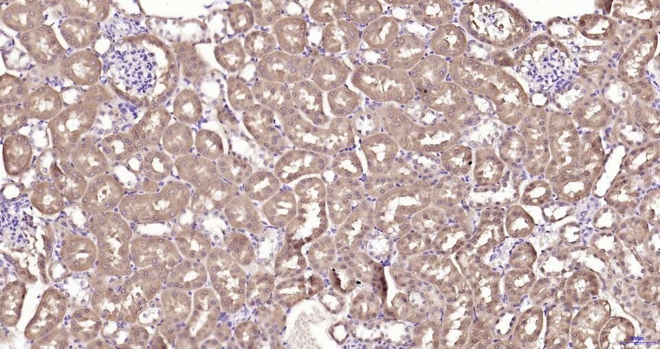 Anti-GPX4 Antibody (1B328)