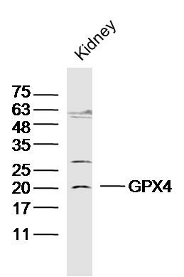 Anti-GPX4 Polyclonal Antibody