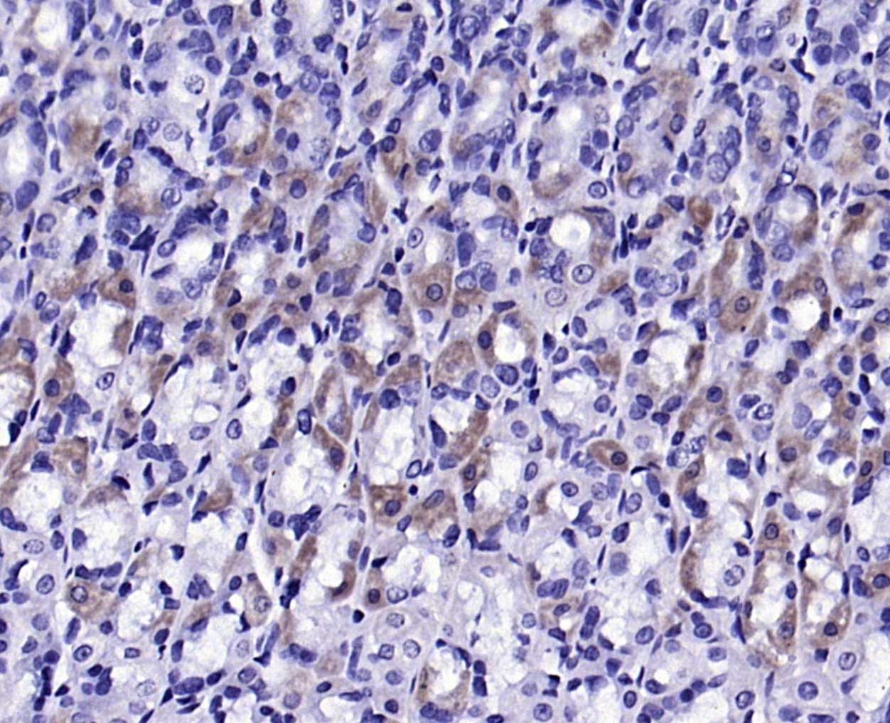 Anti-Gremlin-1 Polyclonal Antibody