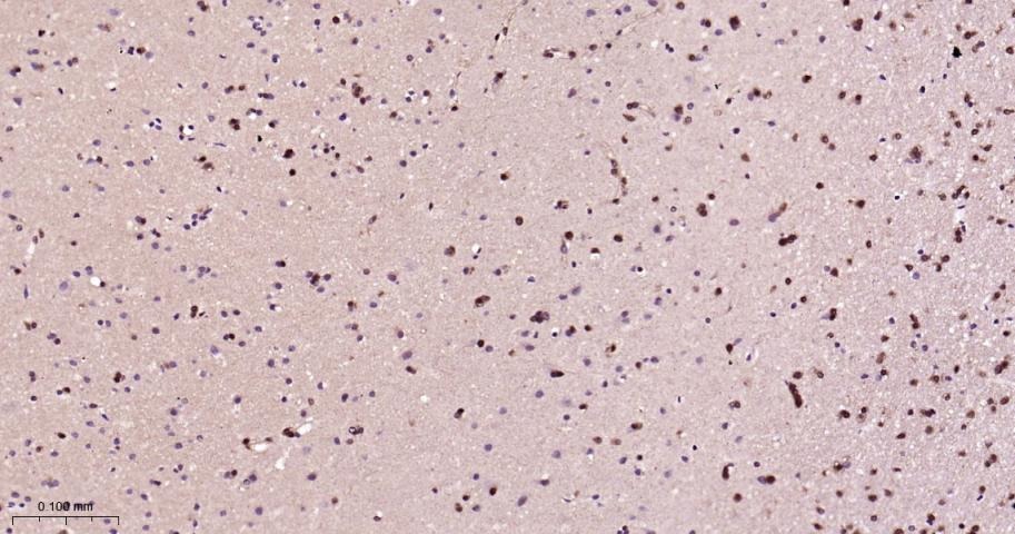 Anti-HSP70 Antibody (9K165)