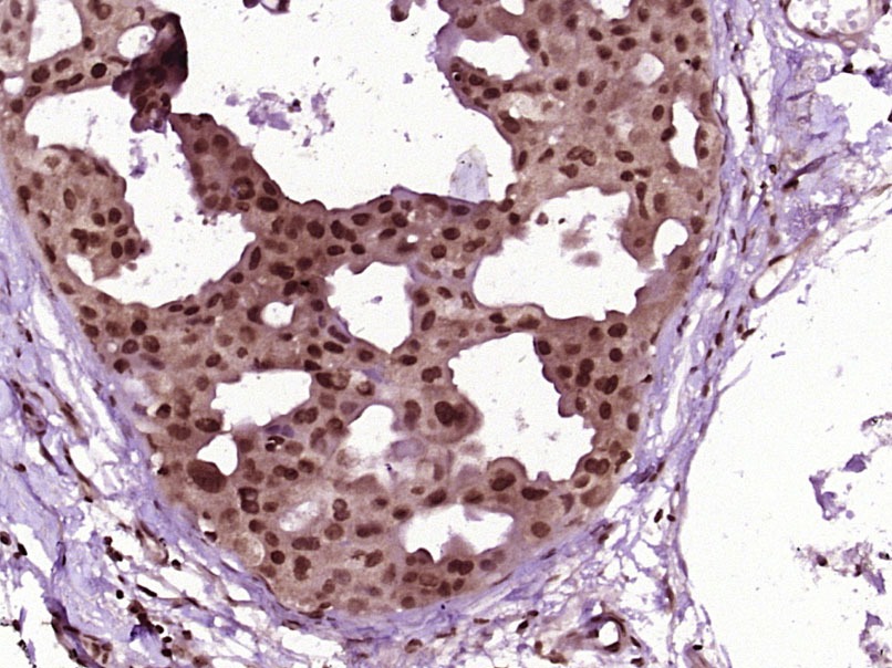 Anti-HSP70 Polyclonal Antibody 2