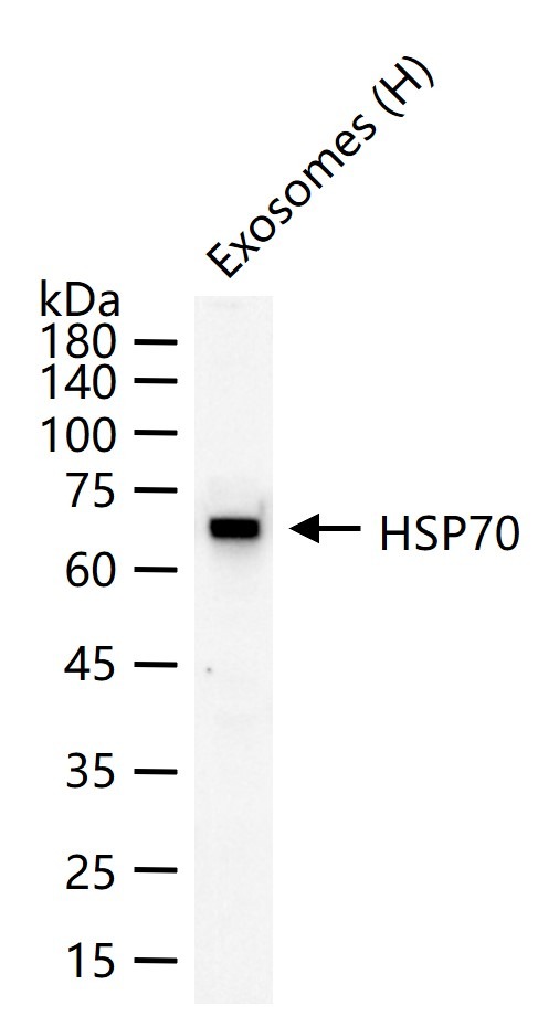 Anti-HSP70 Antibody (9K165)