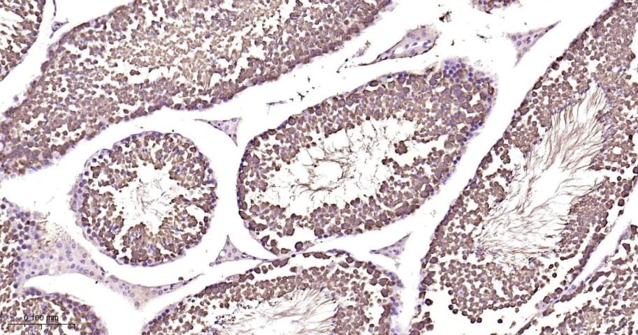 Anti-HSP70 Antibody (9K165)