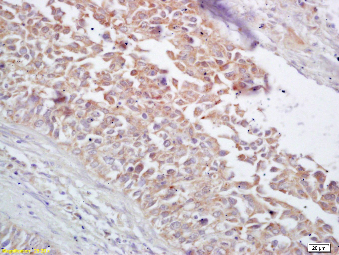 Anti-HSP60 Polyclonal Antibody