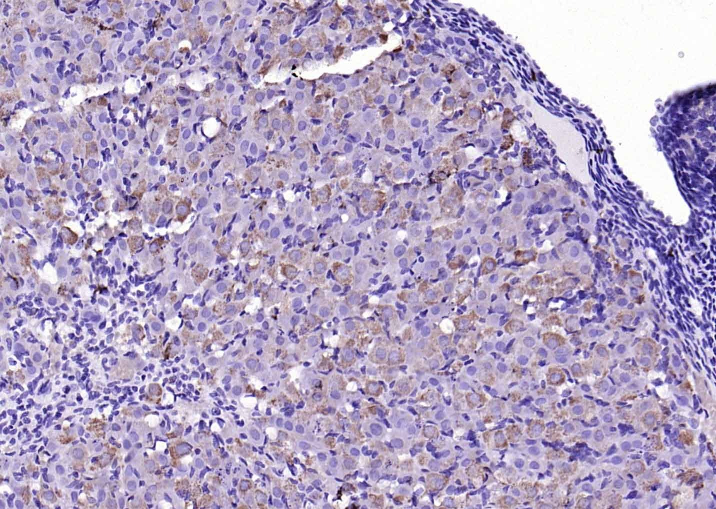 Anti-HSD3B1 Polyclonal Antibody