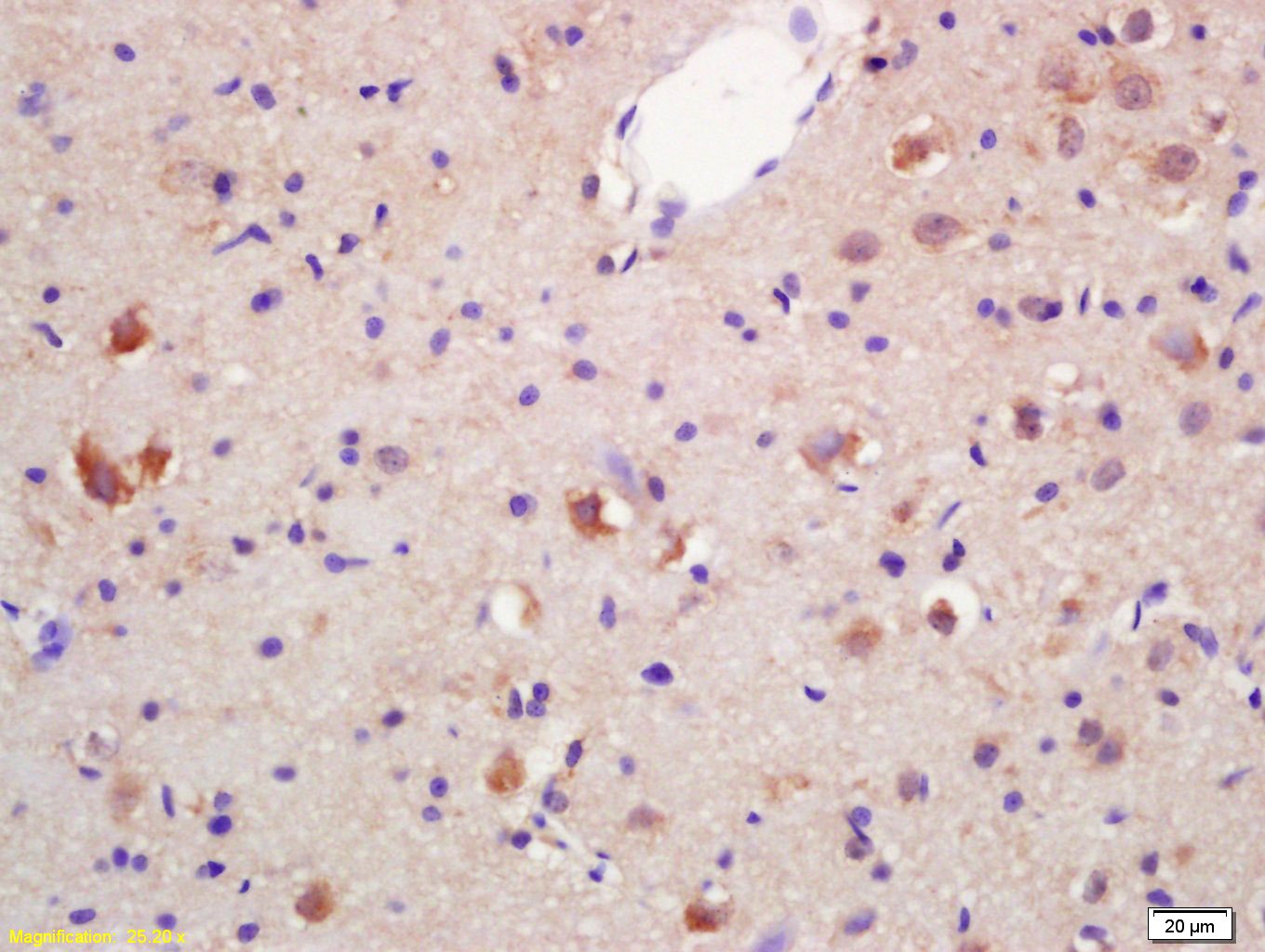 Anti-HSD17B3 Polyclonal Antibody
