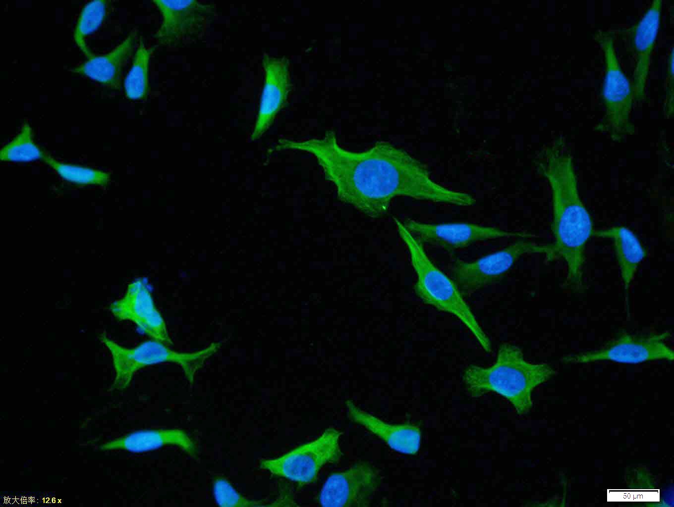 Anti-HSP70 Polyclonal Antibody 2