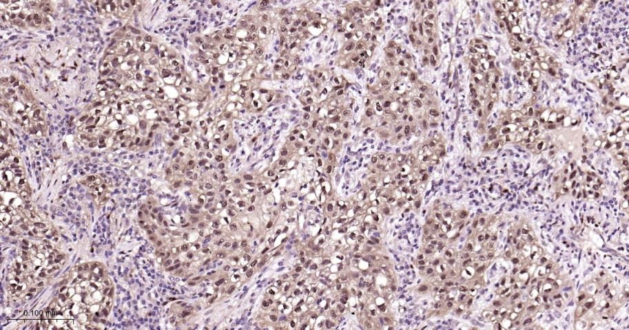 Anti-HSP70 Antibody (9K165)