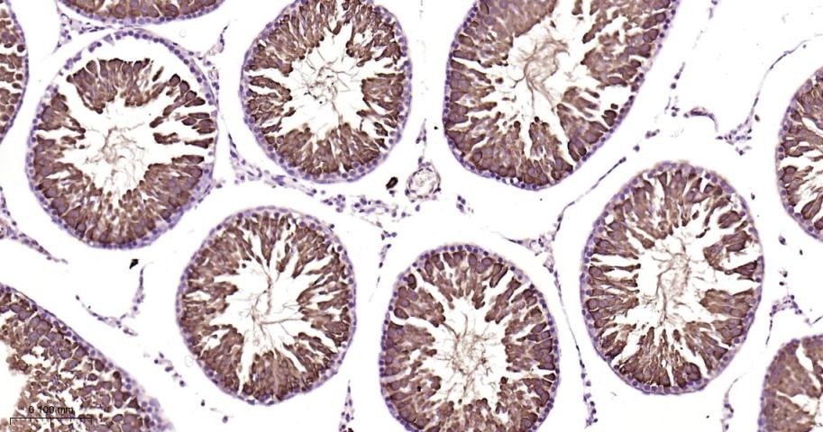 Anti-HSP70 Antibody (9K165)