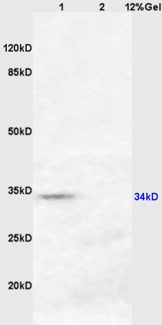 Anti-HSD17B3 Polyclonal Antibody