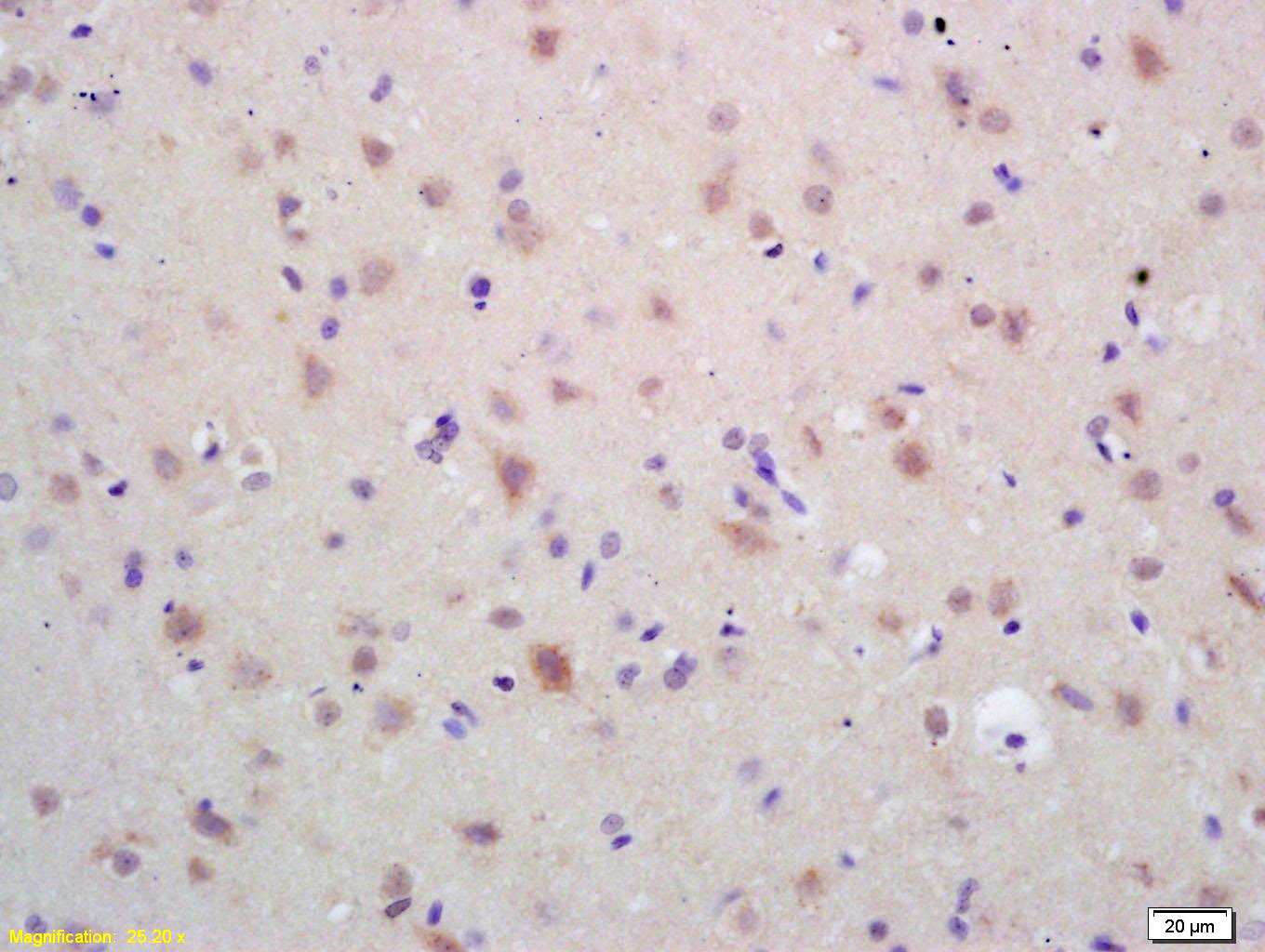 Anti-HSP60 Polyclonal Antibody