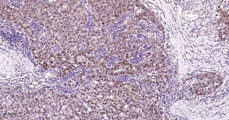 Anti-HSP70 Antibody (9K165)