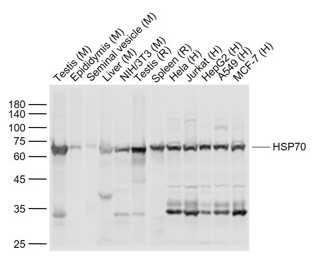 Anti-HSP70 Polyclonal Antibody