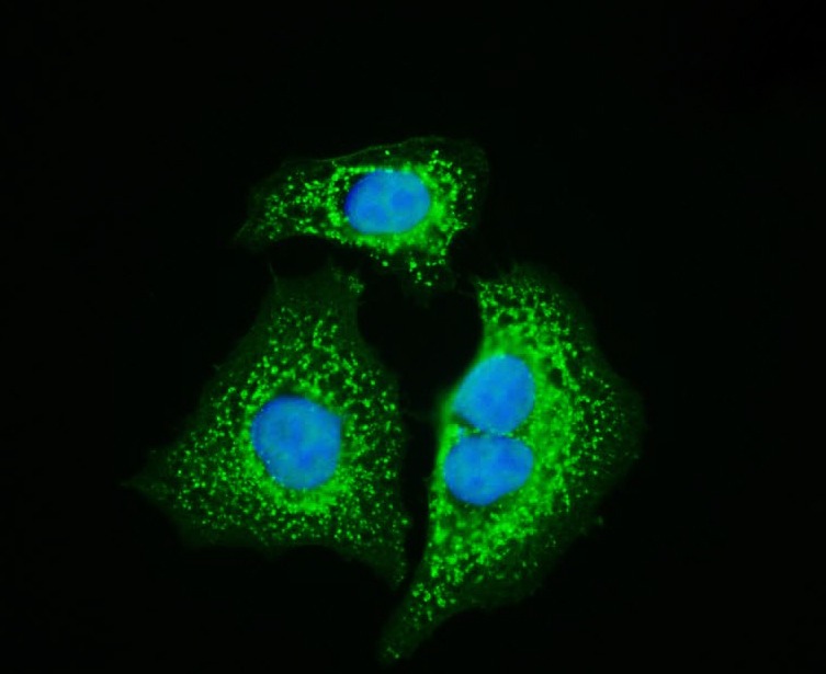 Anti-HSP60 Polyclonal Antibody