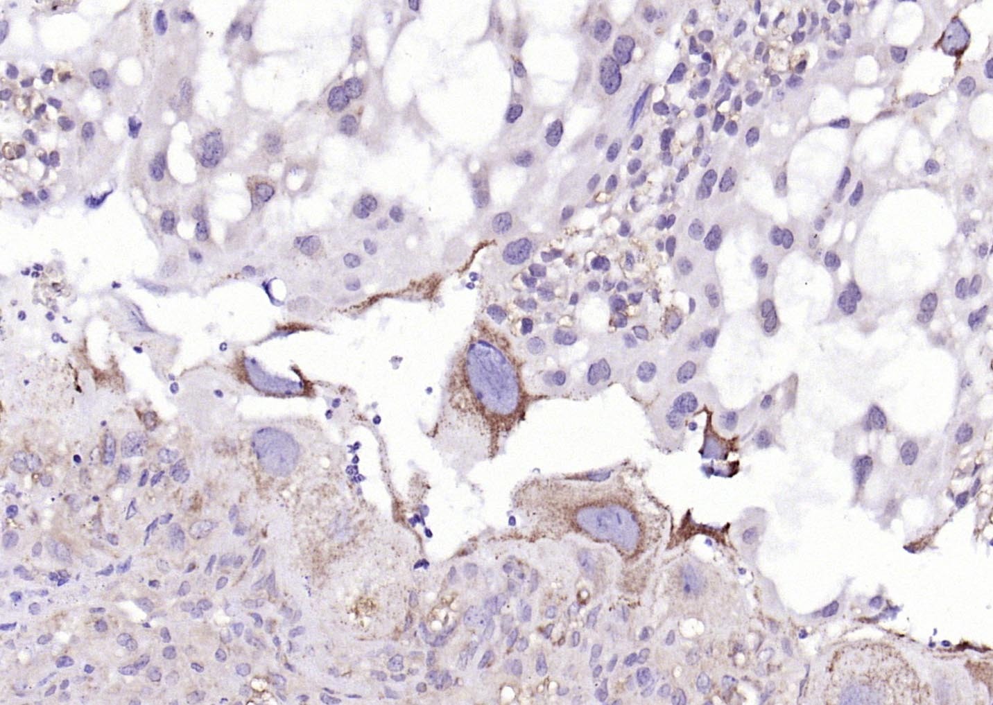 Anti-HSD3B1 Polyclonal Antibody