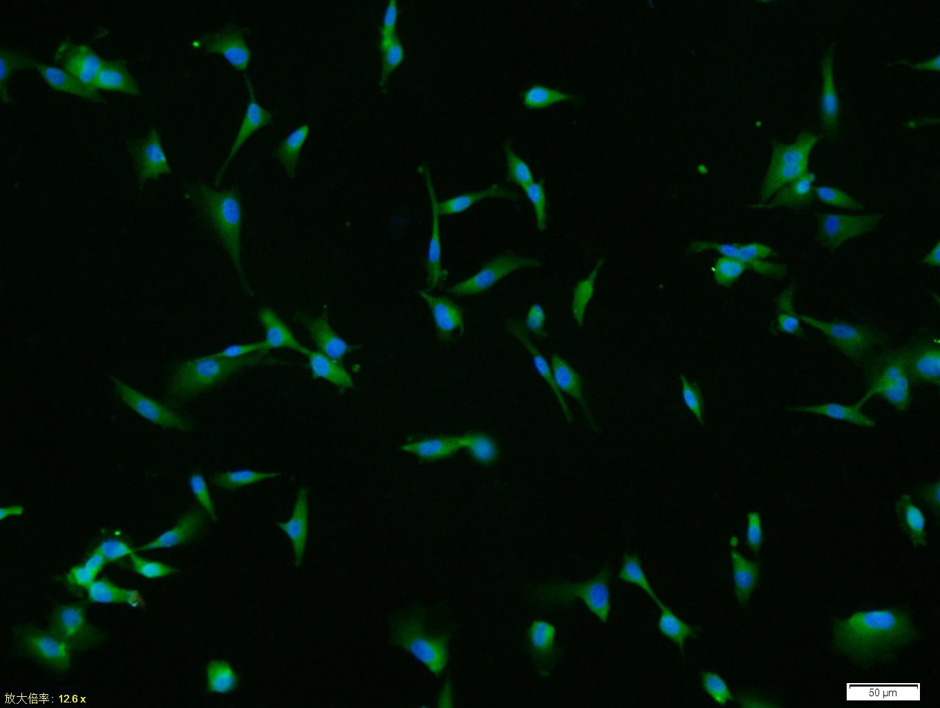 Anti-MMP-2 Polyclonal Antibody 3