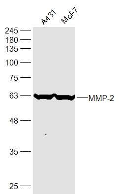 Anti-MMP-2 Polyclonal Antibody 3