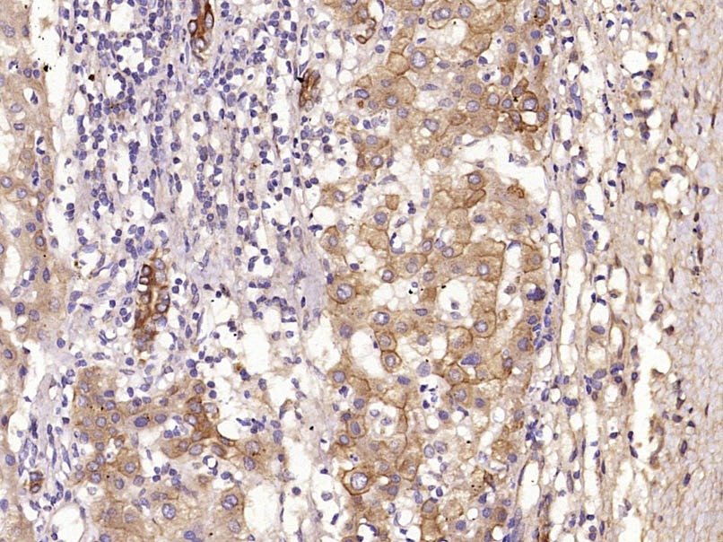 Anti-KRT19 Polyclonal Antibody
