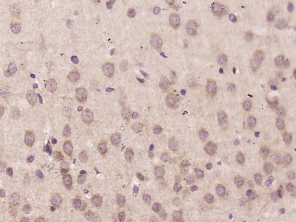 Anti-Coagulation Factor VIII/FVIII/F8 Polyclonal Antibody