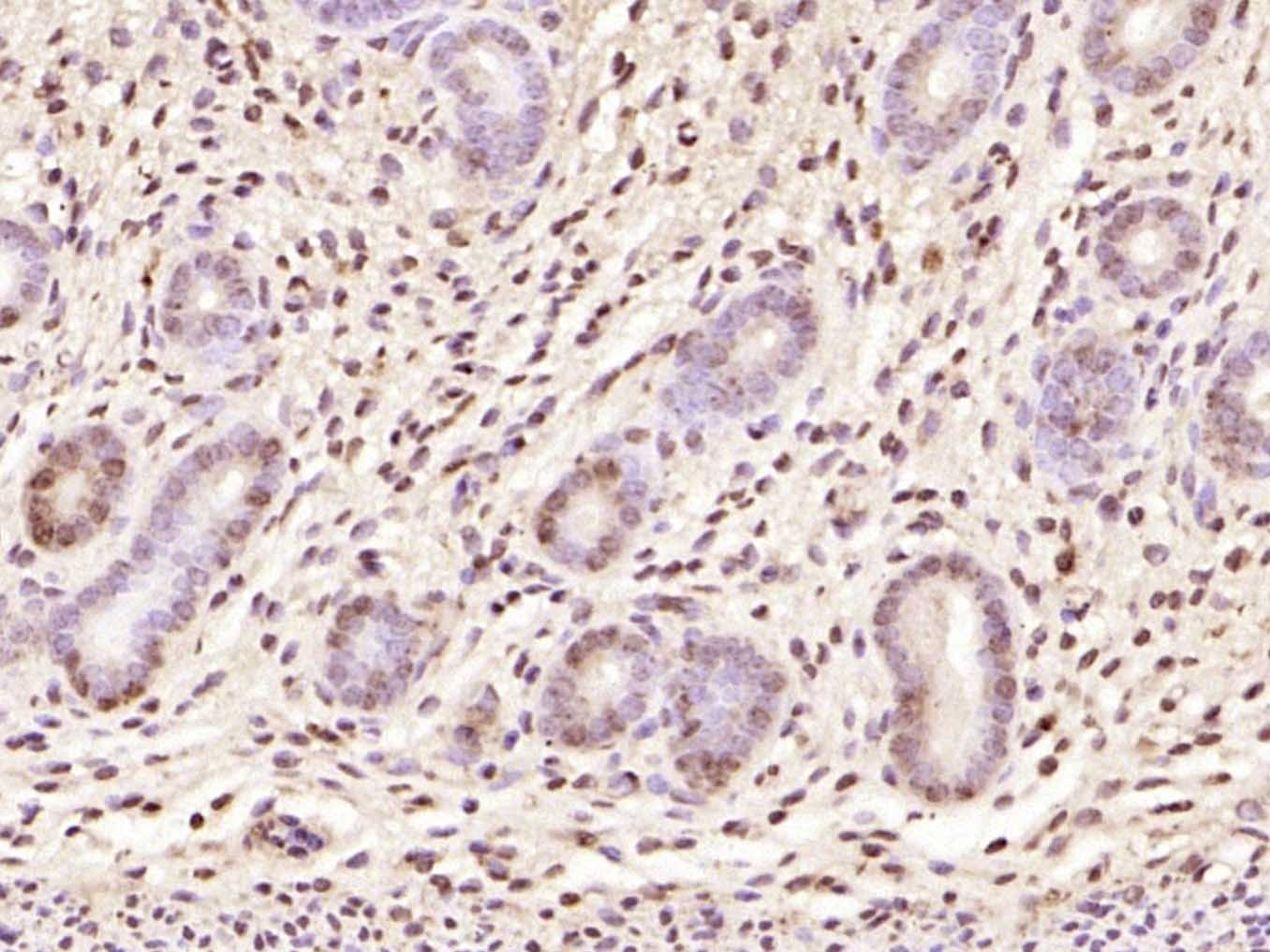 Anti-CDKN1A Polyclonal Antibody