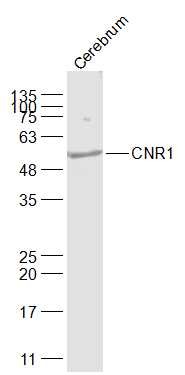 Anti-CNR1 Polyclonal Antibody