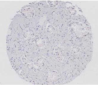 Anti-CDKN1A Polyclonal Antibody