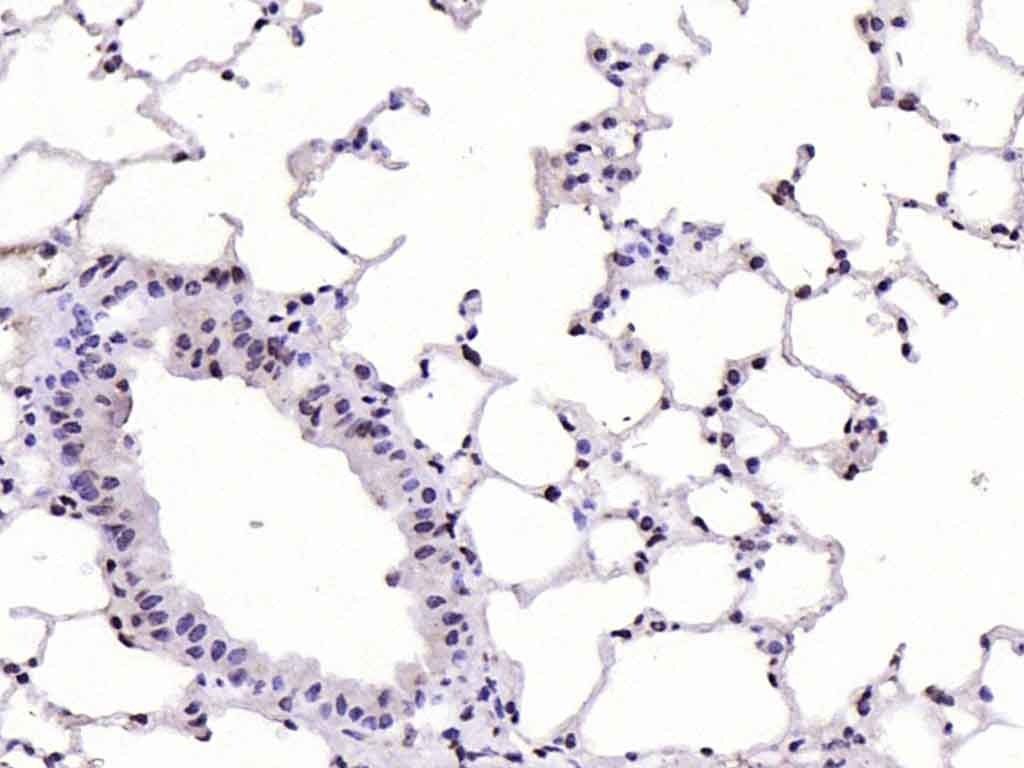 Anti-CDKN1A Polyclonal Antibody