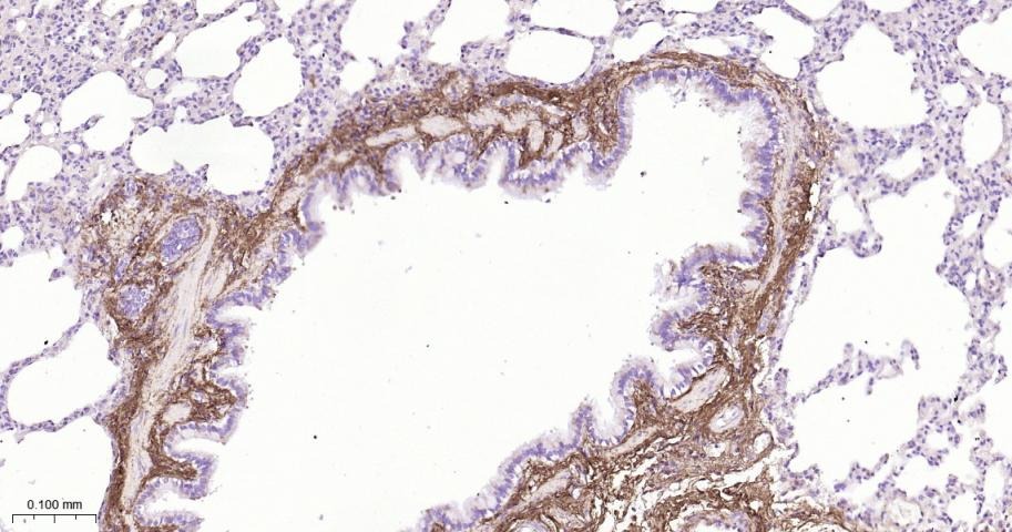 Anti-Collagen I/COL1A1 Polyclonal Antibody 2