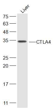 Anti-CTLA4 Polyclonal Antibody
