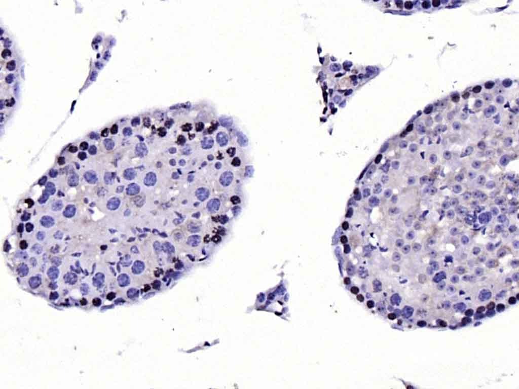 Anti-CDKN1A Polyclonal Antibody