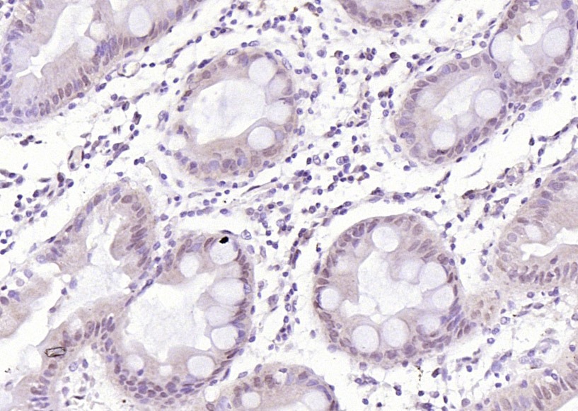 Anti-CDK6 Polyclonal Antibody