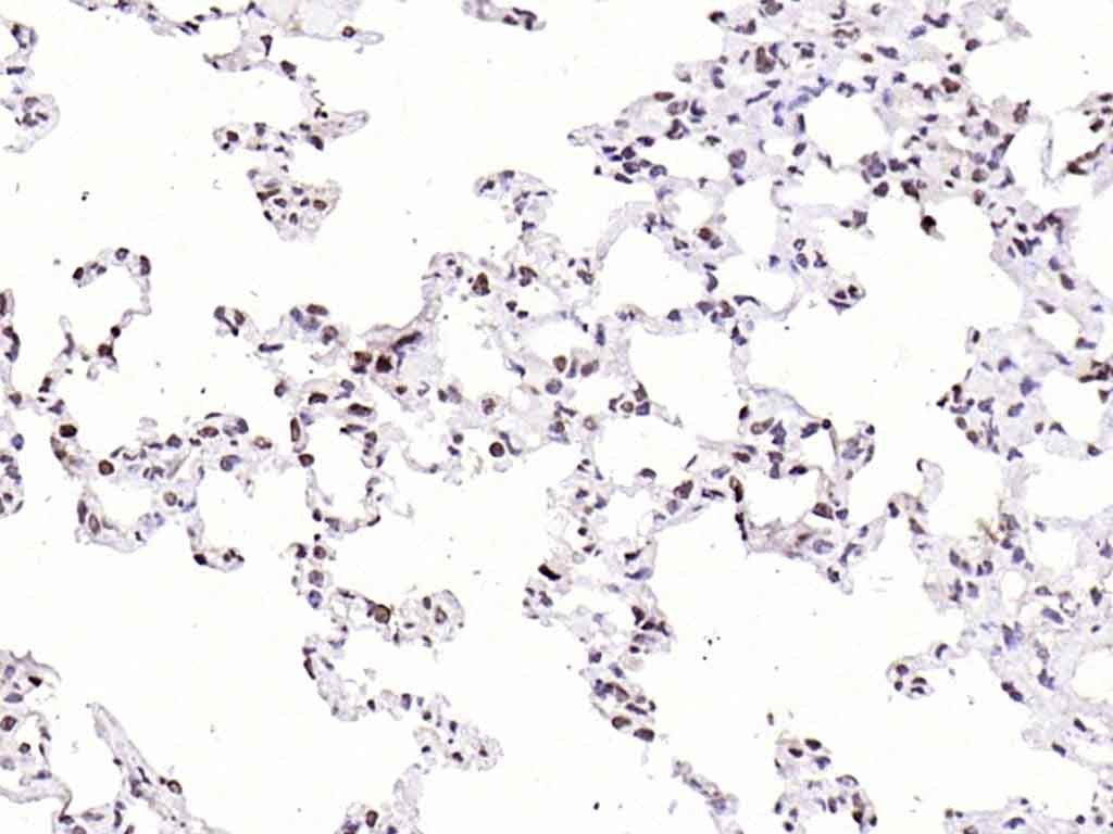 Anti-CDKN1A Polyclonal Antibody
