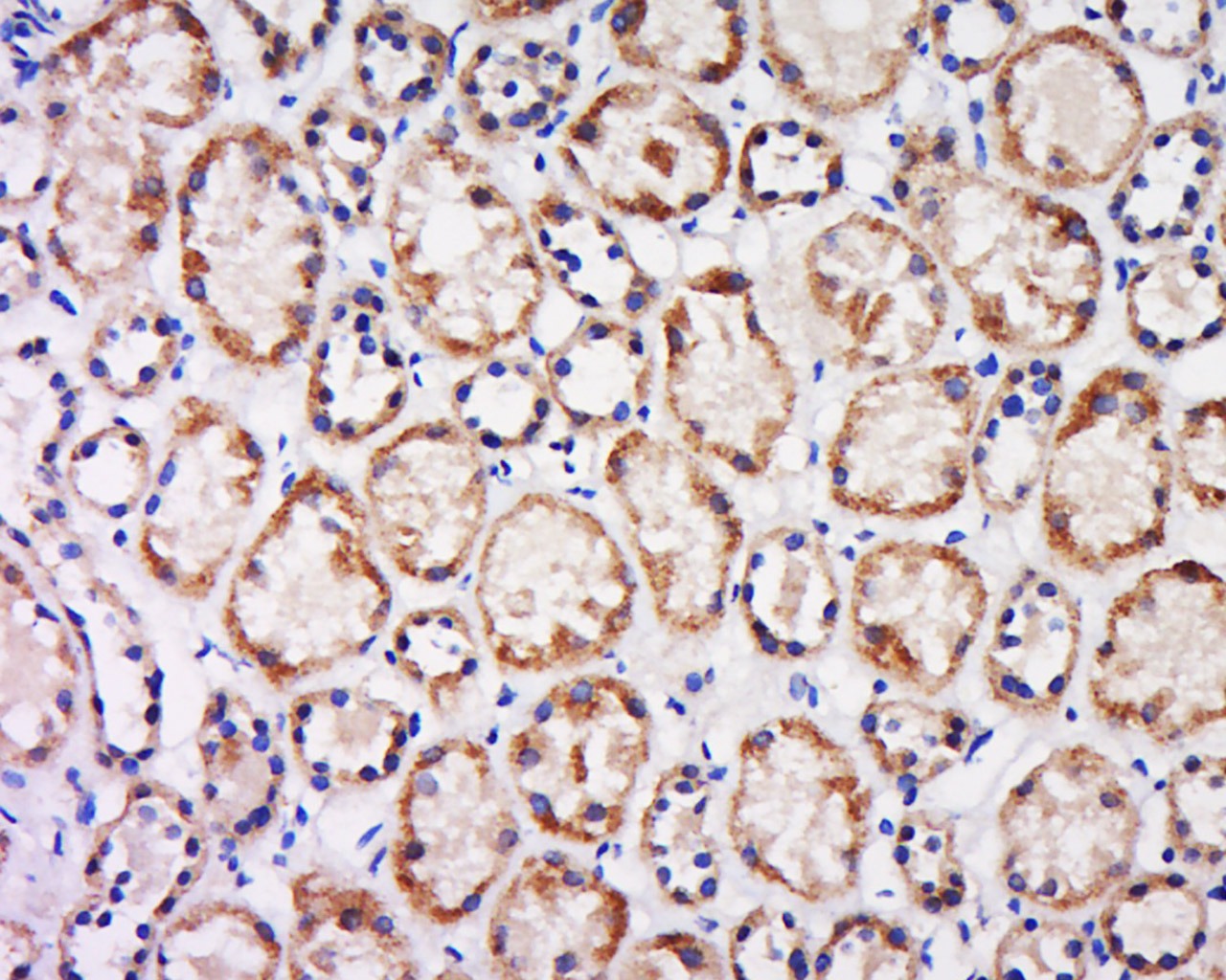 Anti-CX3CL1/Fractalkine Polyclonal Antibody