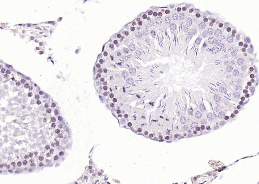 Anti-CDK6 Polyclonal Antibody
